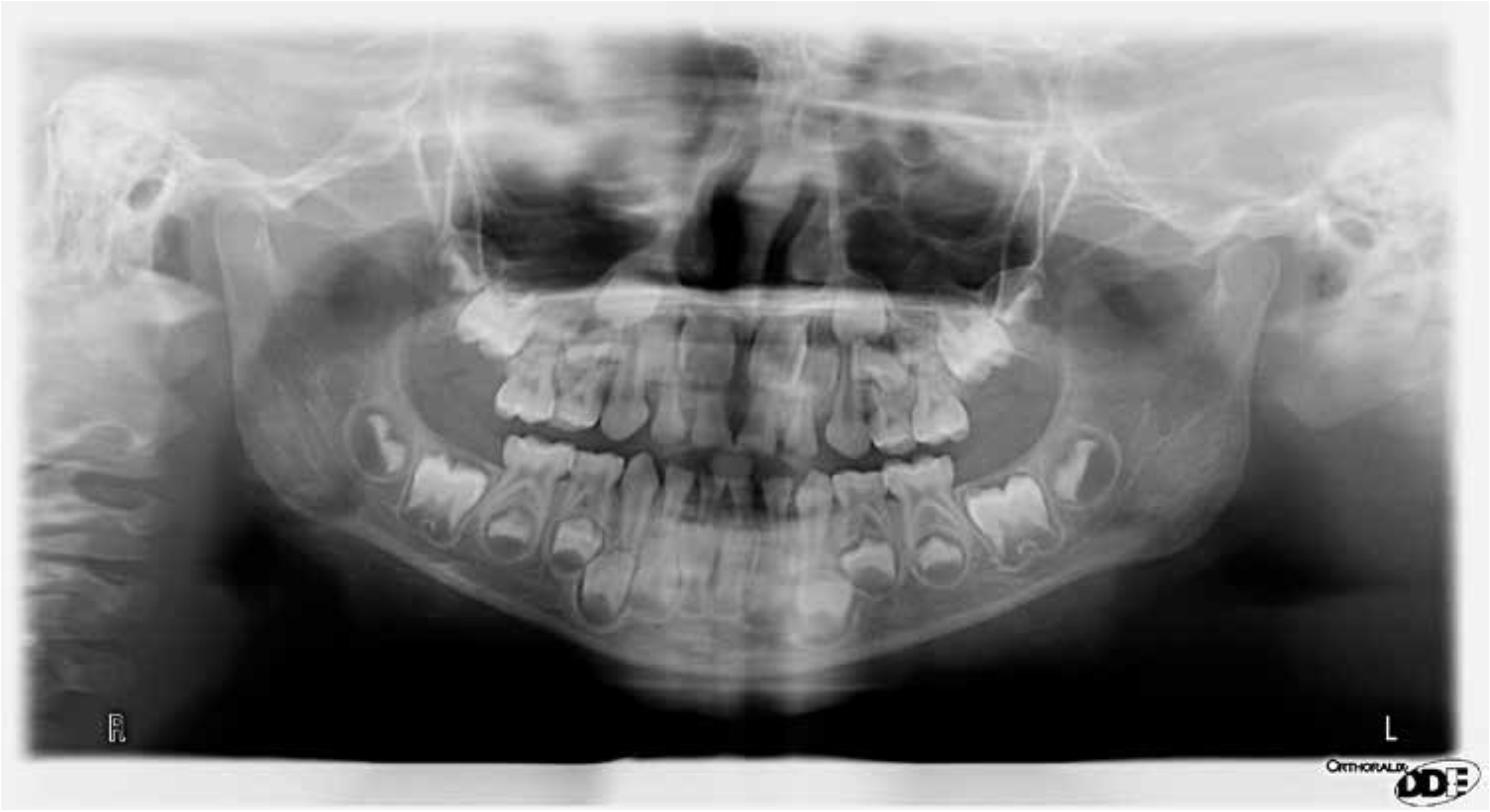 Course Image Žmogaus anatomija Odontologijos programa 1 semestras