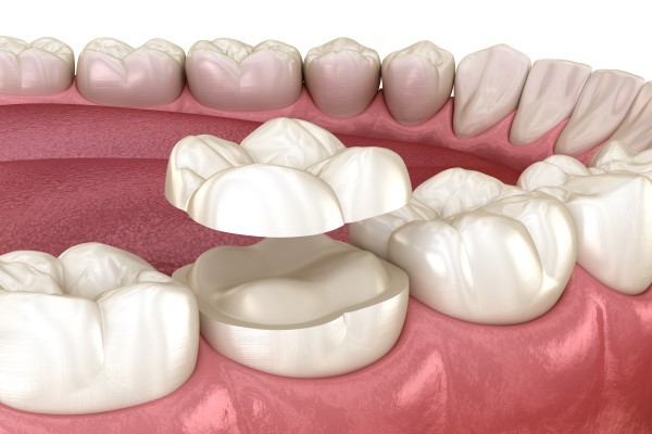 Course Image 2025-26(2) 2y. Preclinical Prosthodontics. Fixed prosthodontics