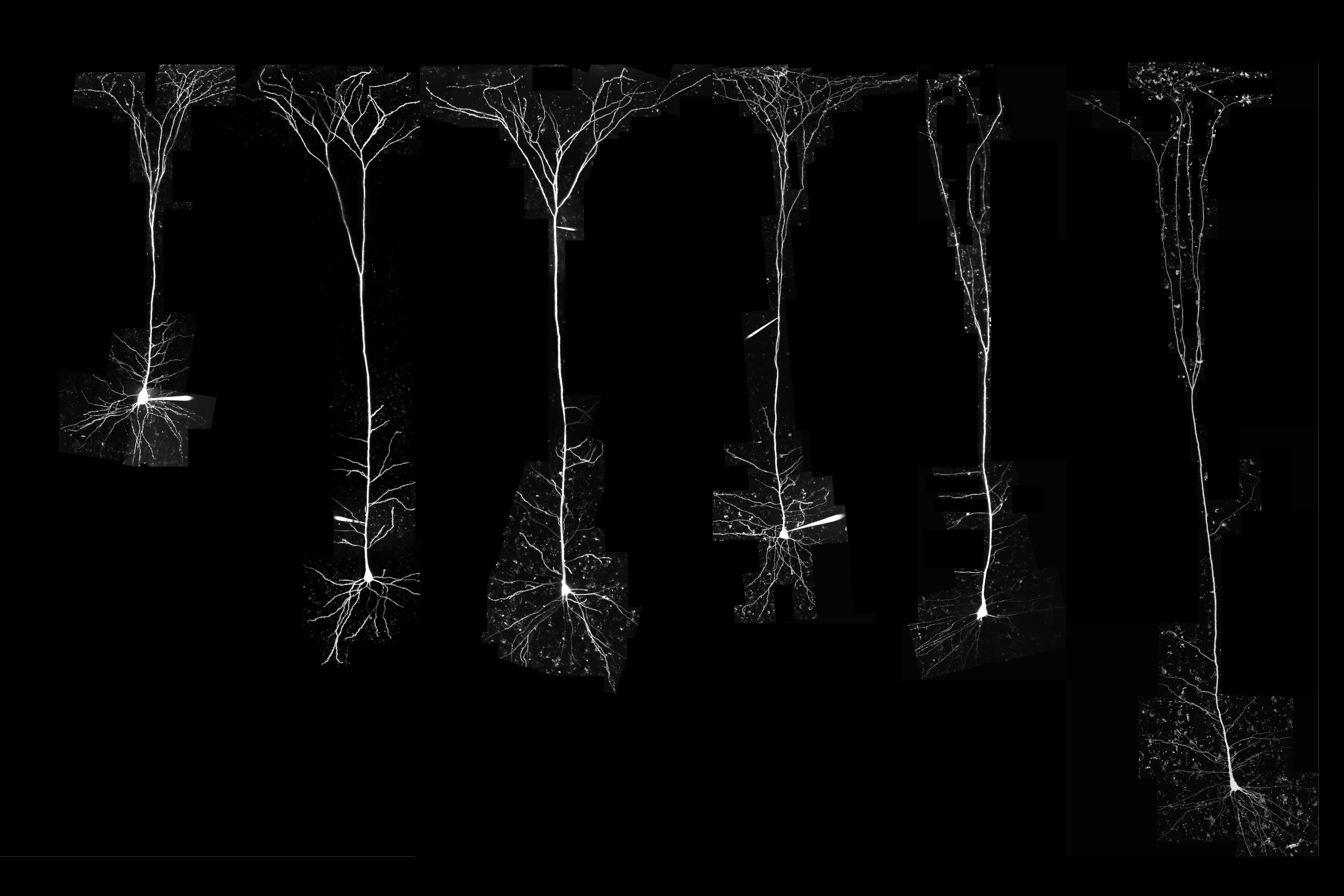 Course Image Neurology and Neurosurgery (E)